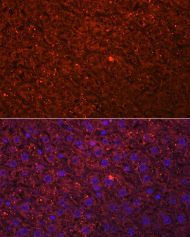 HSD17B13 Antibody in Immunocytochemistry (ICC/IF)