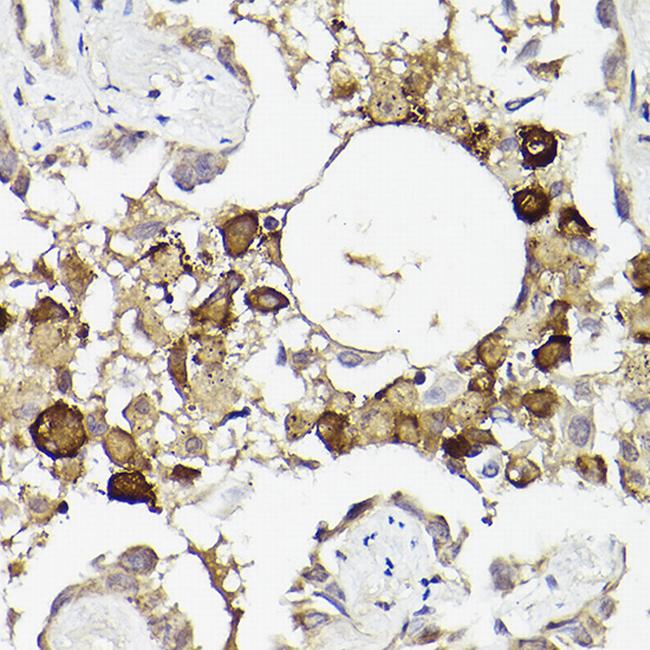 IL6R Antibody in Immunohistochemistry (Paraffin) (IHC (P))