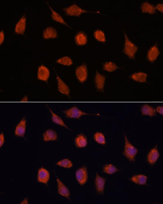 KCNAB2 Antibody in Immunocytochemistry (ICC/IF)