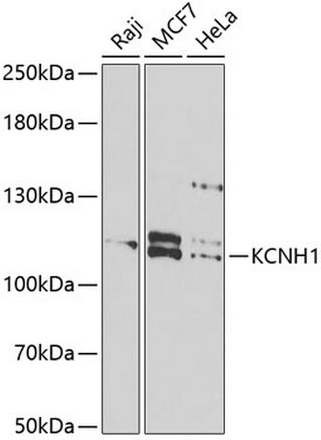 KCNH1 Antibody in Western Blot (WB)