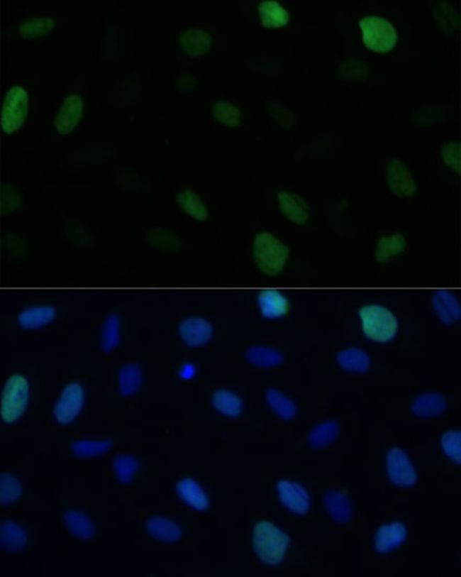 KIFC1 Antibody in Immunocytochemistry (ICC/IF)