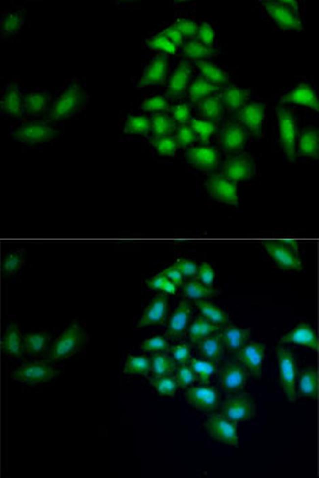 KLK4 Antibody in Immunocytochemistry (ICC/IF)