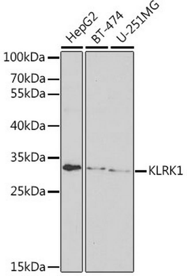 NKG2D Antibody in Western Blot (WB)