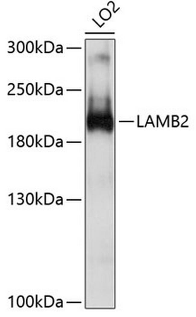 LAMB2 Antibody in Western Blot (WB)