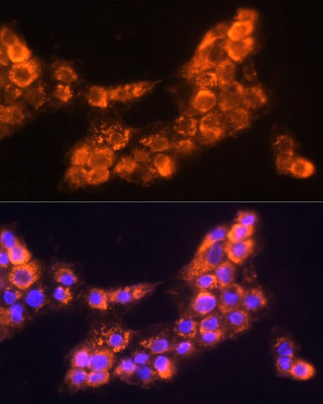 LAMC2 Antibody in Immunocytochemistry (ICC/IF)