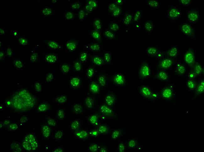 LDLRAP1 Antibody in Immunocytochemistry (ICC/IF)