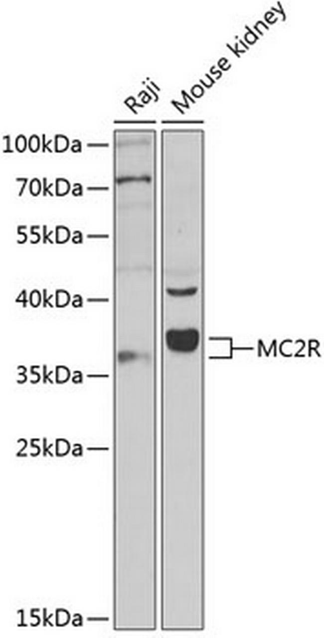 MC2R Antibody in Western Blot (WB)