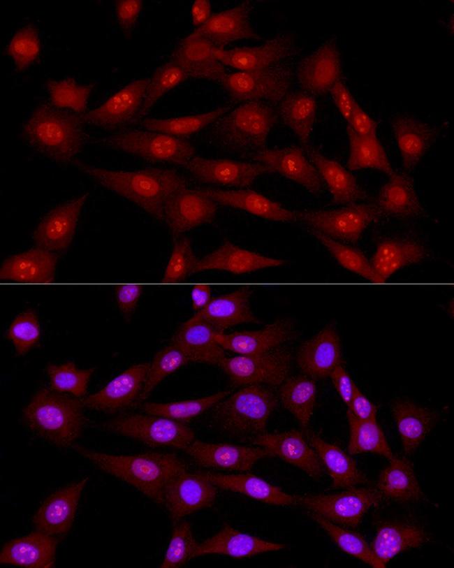 LIG3 Antibody in Immunocytochemistry (ICC/IF)