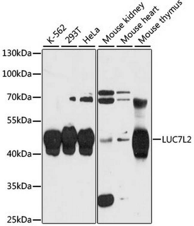 LUC7L2 Antibody in Western Blot (WB)