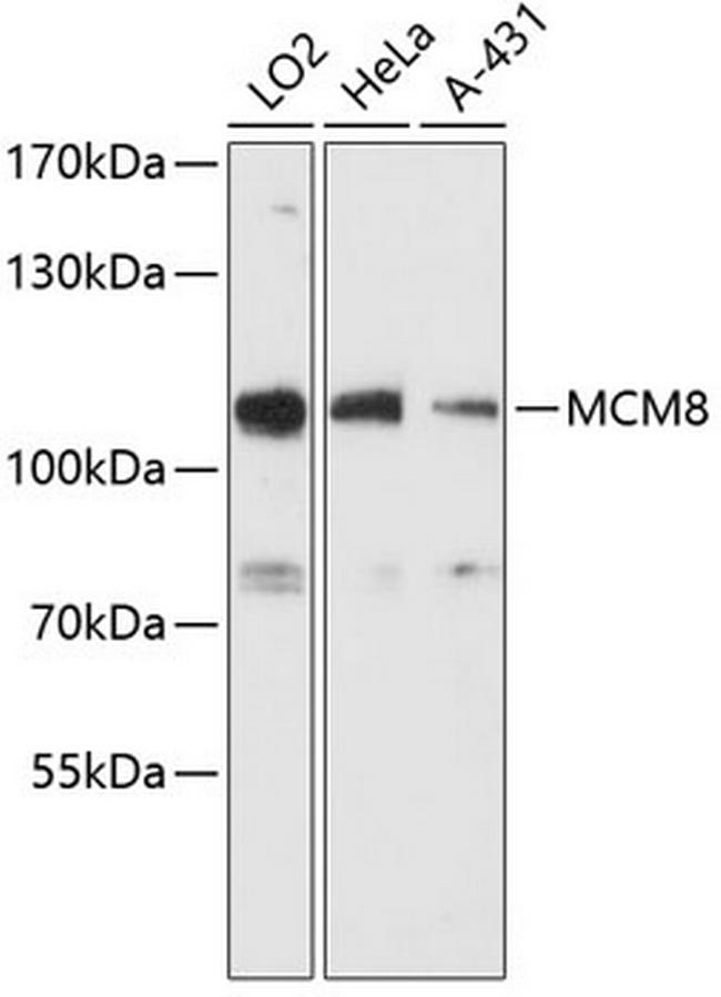 MCM8 Antibody in Western Blot (WB)