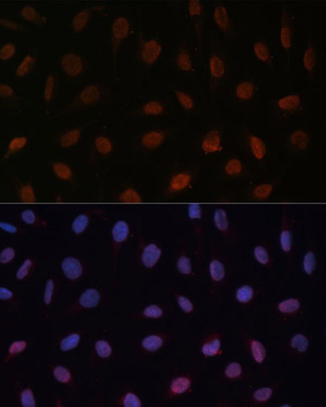 MED25 Antibody in Immunocytochemistry (ICC/IF)