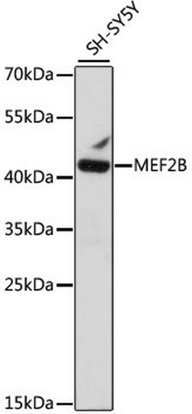 MEF2B Antibody in Western Blot (WB)