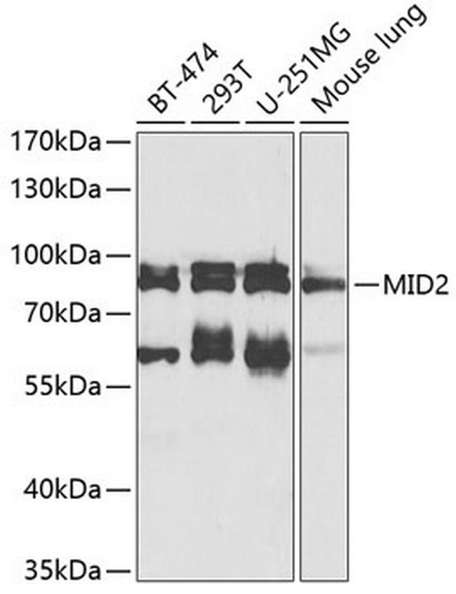 MID2 Antibody in Western Blot (WB)