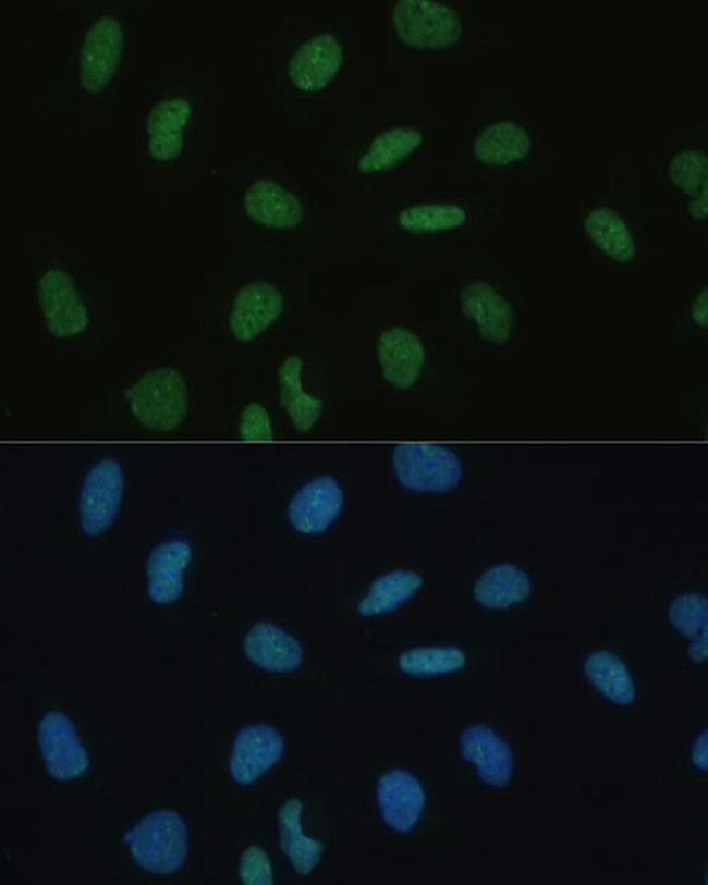 MKL1 Antibody in Immunocytochemistry (ICC/IF)