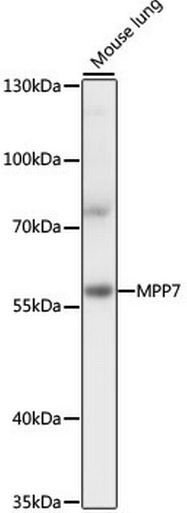 MPP7 Antibody in Western Blot (WB)