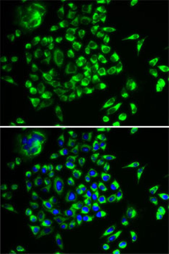 MRPL28 Antibody in Immunocytochemistry (ICC/IF)