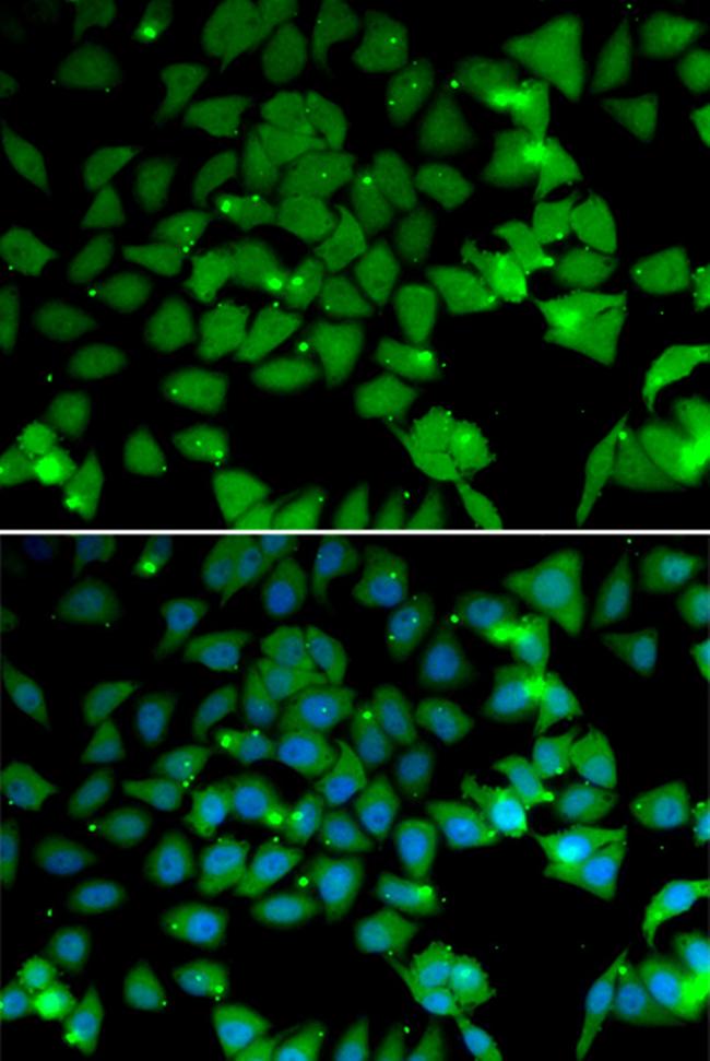 ARD1A Antibody in Immunocytochemistry (ICC/IF)