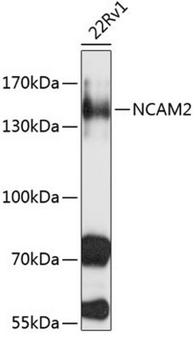 NCAM2 Antibody in Western Blot (WB)