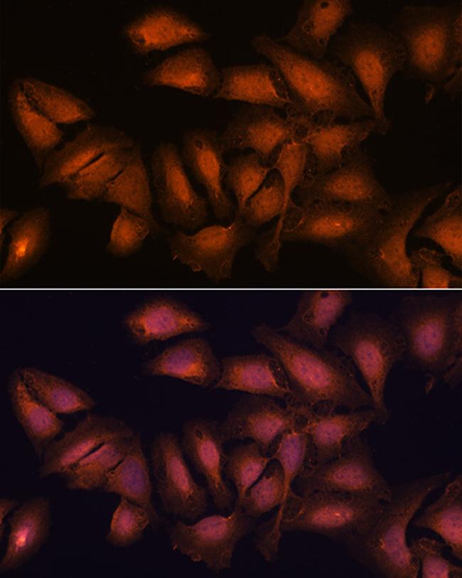 NCAPD2 Antibody in Immunocytochemistry (ICC/IF)