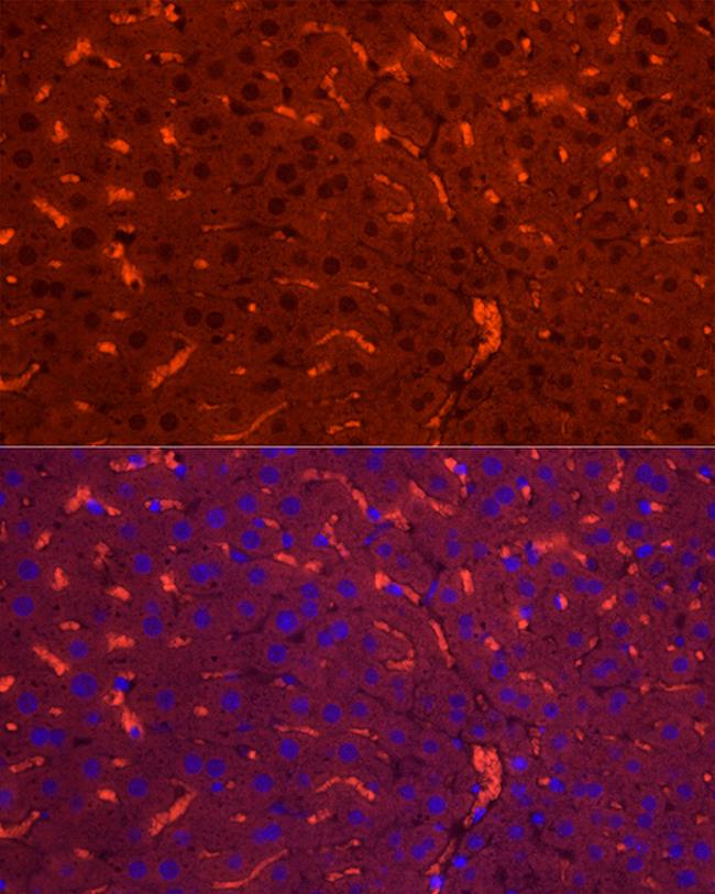 NNMT Antibody in Immunocytochemistry (ICC/IF)