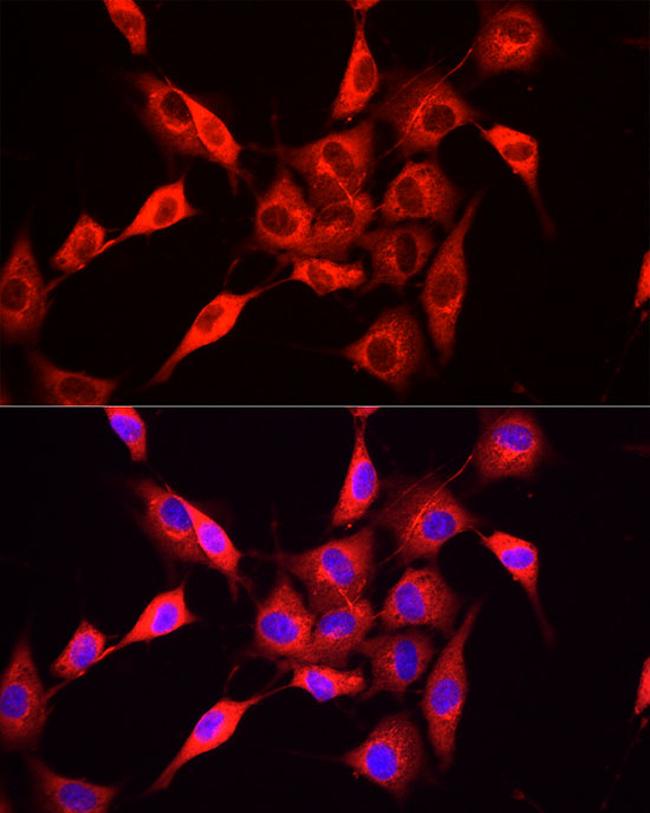 NNMT Antibody in Immunocytochemistry (ICC/IF)