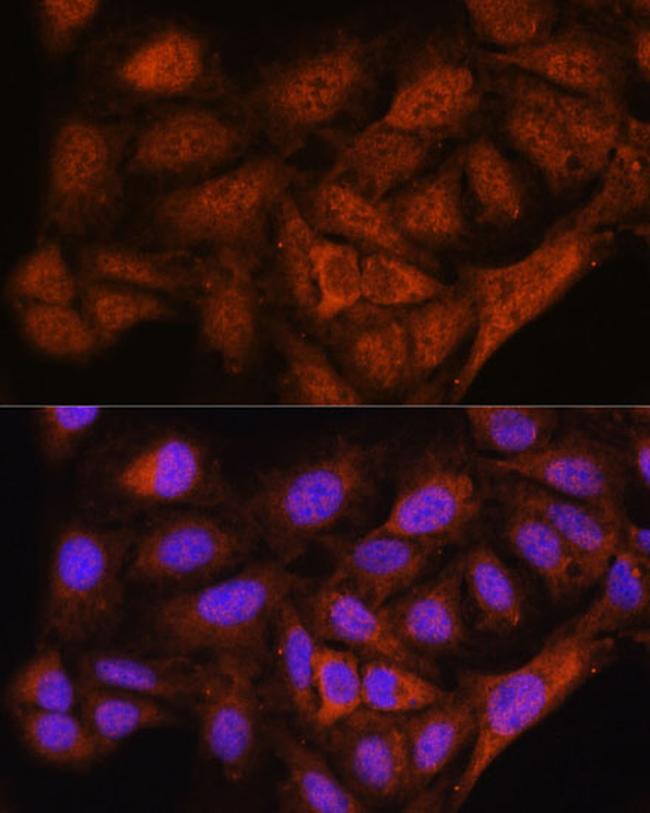 NOB1 Antibody in Immunocytochemistry (ICC/IF)