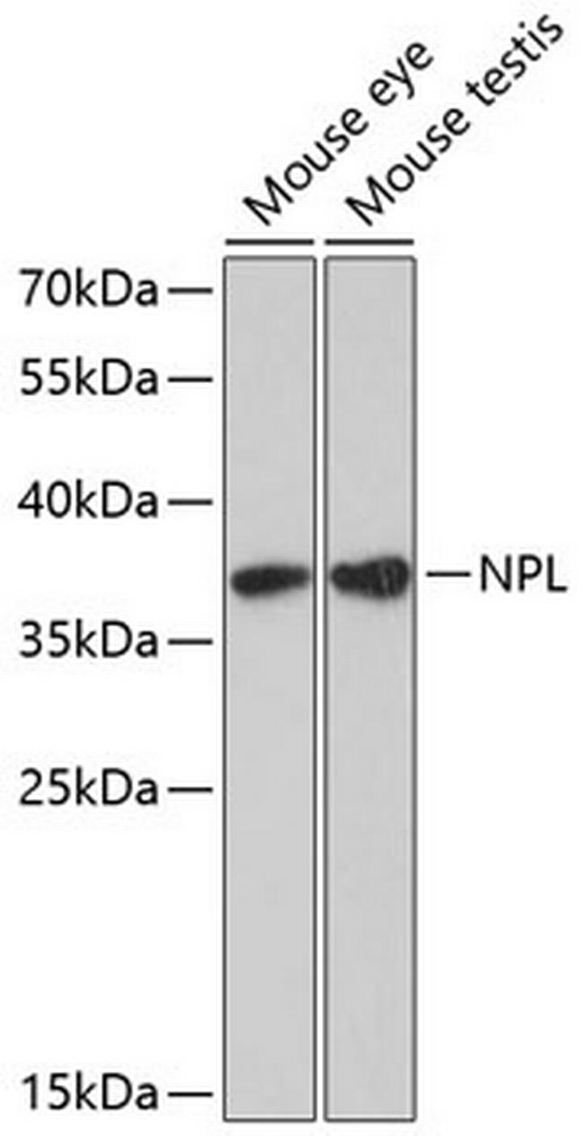 NPL Antibody in Western Blot (WB)