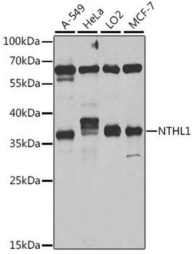 NTHL1 Antibody in Western Blot (WB)