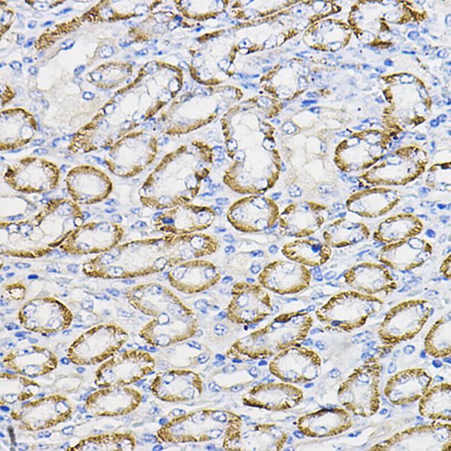 NUBP1 Antibody in Immunohistochemistry (Paraffin) (IHC (P))