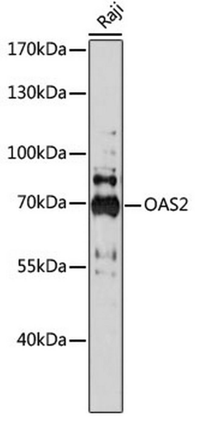 OAS2 Antibody in Western Blot (WB)