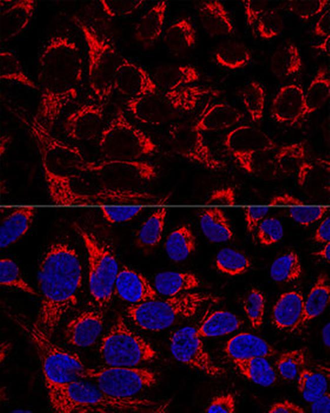 OCIAD1 Antibody in Immunocytochemistry (ICC/IF)