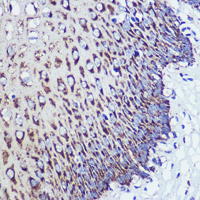 ORP8 Antibody in Immunohistochemistry (Paraffin) (IHC (P))