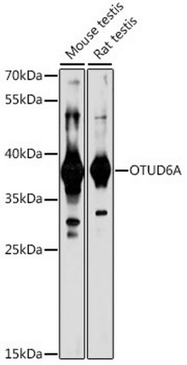 OTUD6A Antibody in Western Blot (WB)