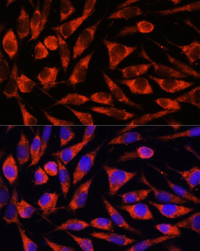 OTUD7B Antibody in Immunocytochemistry (ICC/IF)