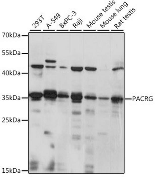 PACRG Antibody in Western Blot (WB)