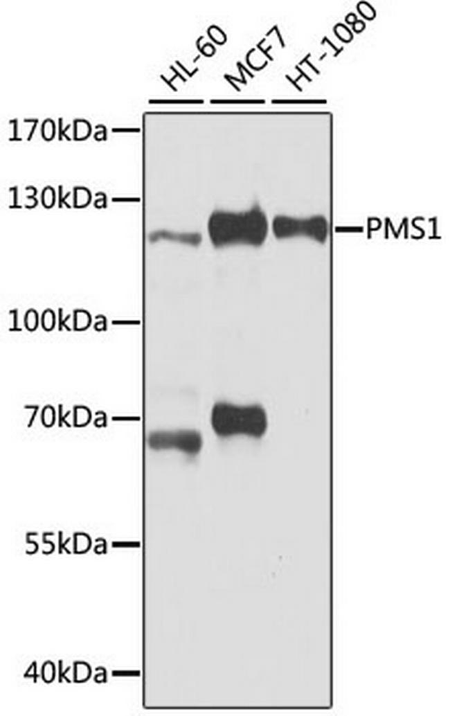 PDGFRB Antibody in Western Blot (WB)