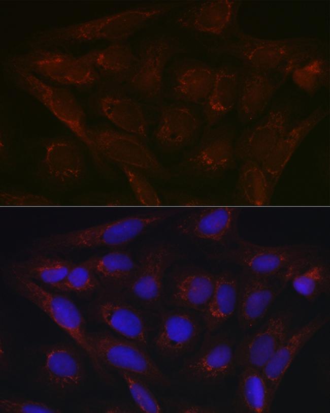 PDK4 Antibody in Immunocytochemistry (ICC/IF)