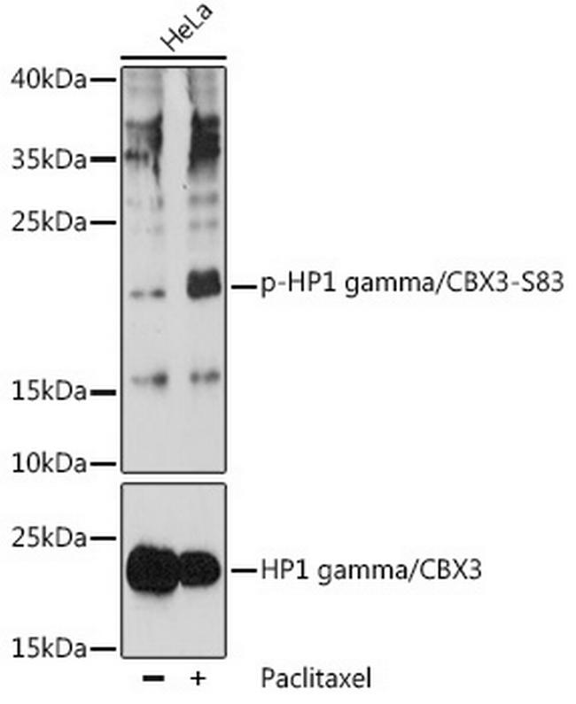 Phospho-HP1 gamma (Ser83) Antibody in Western Blot (WB)