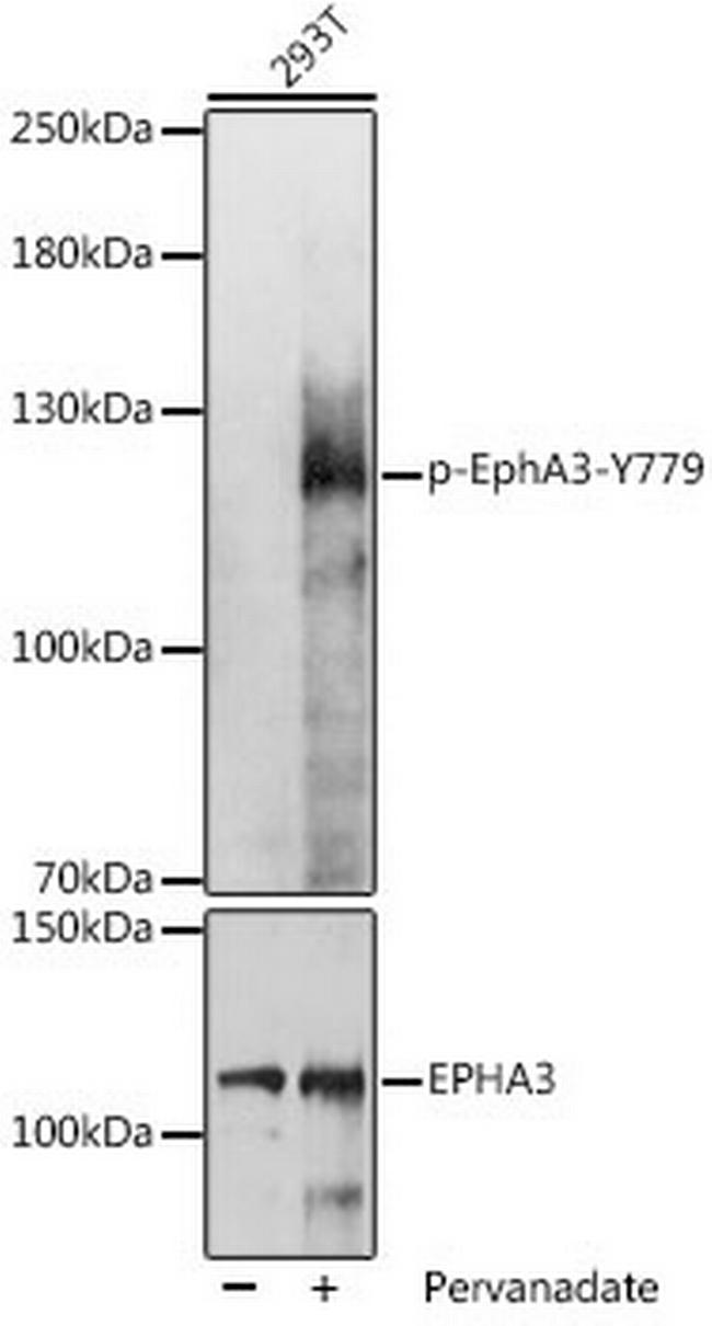 Phospho-EphA3 (Tyr779) Antibody in Western Blot (WB)