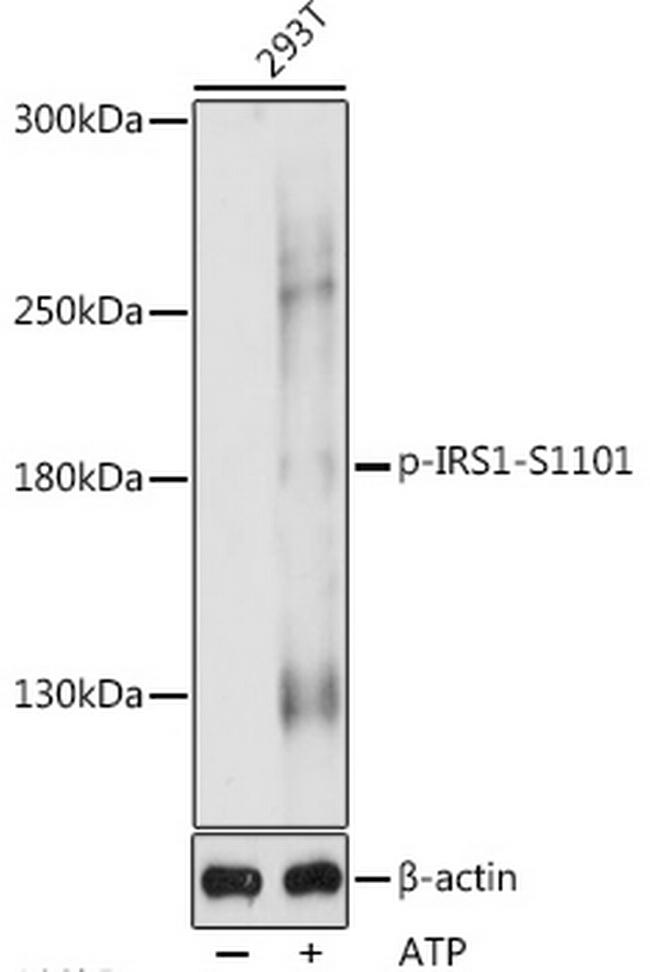 Phospho-IRS1 (Ser1101) Antibody in Western Blot (WB)