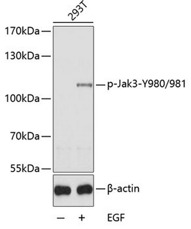 Phospho-JAK3 (Tyr980, Tyr981) Antibody in Western Blot (WB)