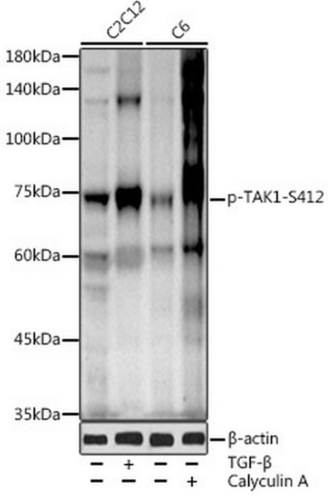 Phospho-TAK1 (Ser412) Antibody in Western Blot (WB)