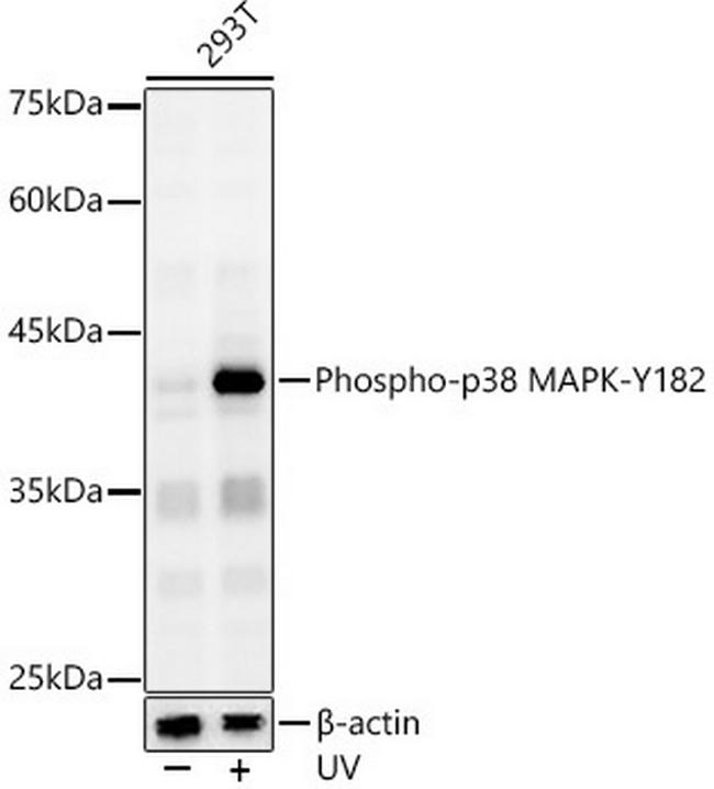 Phospho-p38 MAPK alpha (Tyr182) Antibody in Western Blot (WB)