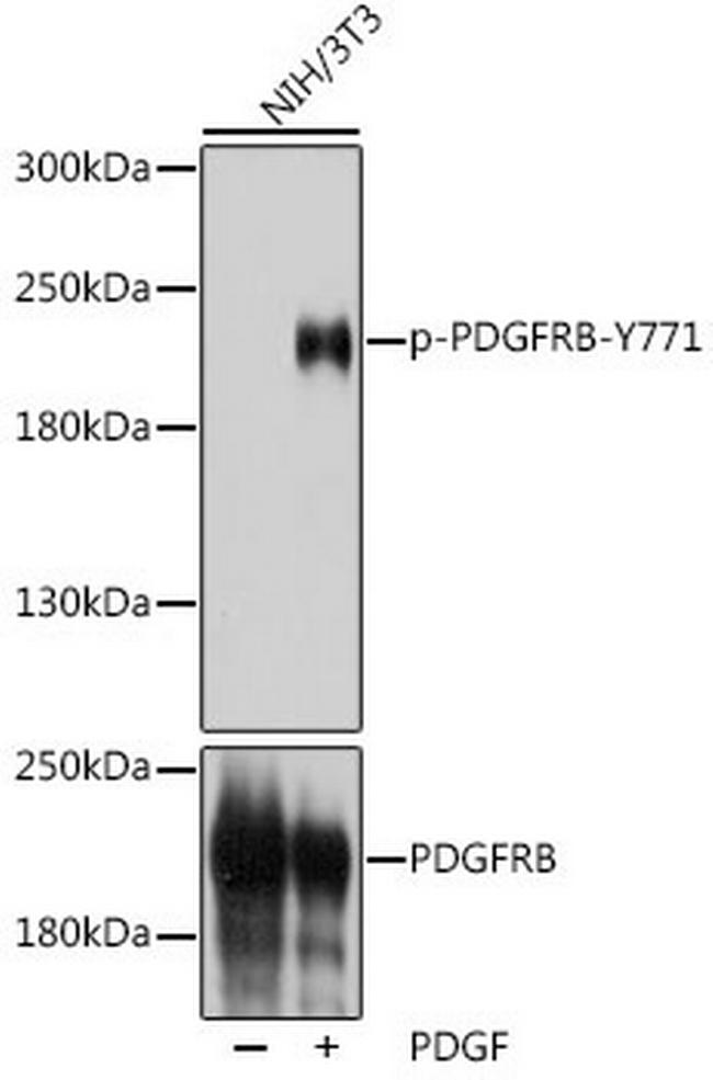 Phospho-PDGFRB (Tyr771) Antibody in Western Blot (WB)