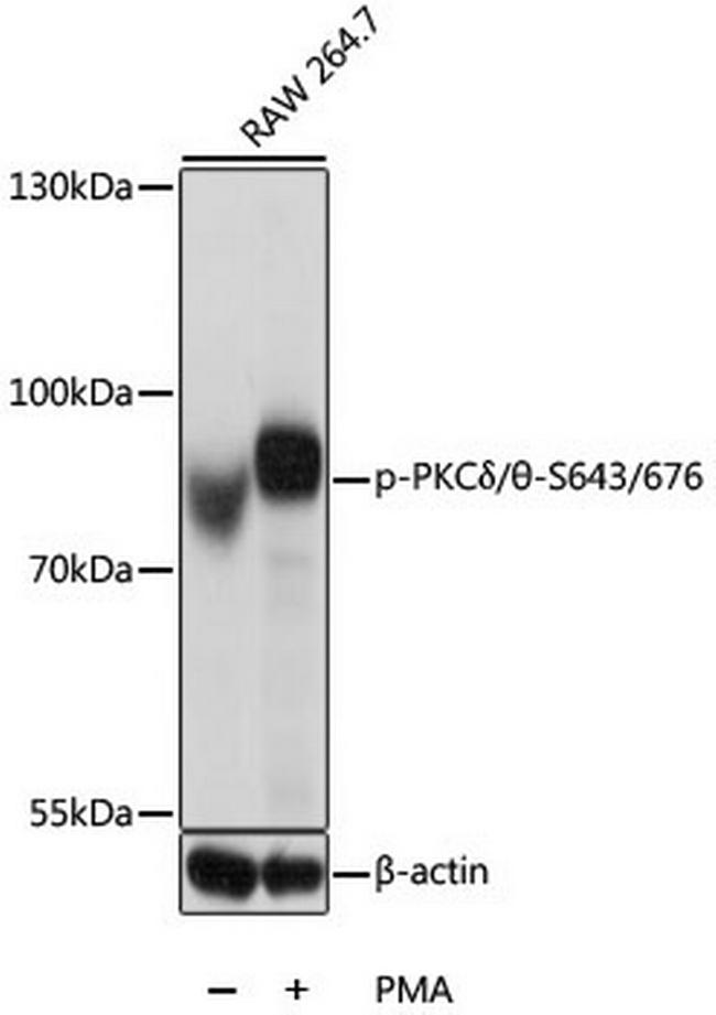 Phospho-PKC delta/theta (Ser643, Ser676) Antibody in Western Blot (WB)