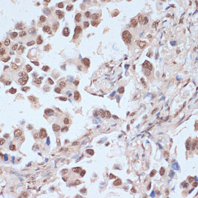 Phospho-AMPK alpha-1,2 (Thr183, Thr172) Antibody in Immunohistochemistry (Paraffin) (IHC (P))