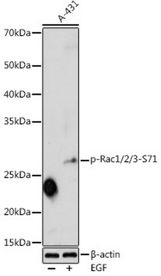 Phospho-RAC1 (Ser71) Antibody in Western Blot (WB)