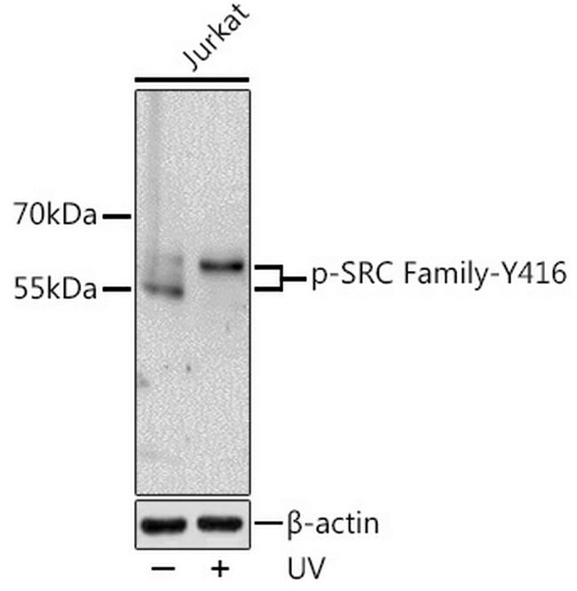 Phospho-LCK/FYN (Tyr416) Antibody in Western Blot (WB)