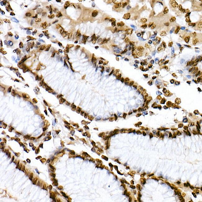 Phospho-STAT6 (Tyr641) Antibody in Immunohistochemistry (Paraffin) (IHC (P))