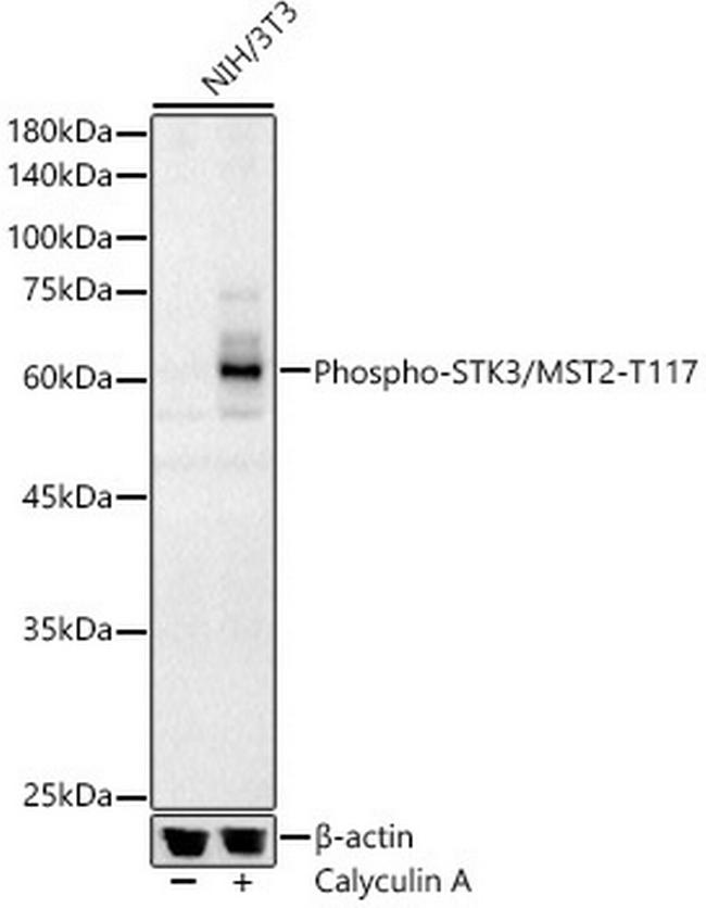 Phospho-MST2 (Thr117) Antibody in Western Blot (WB)